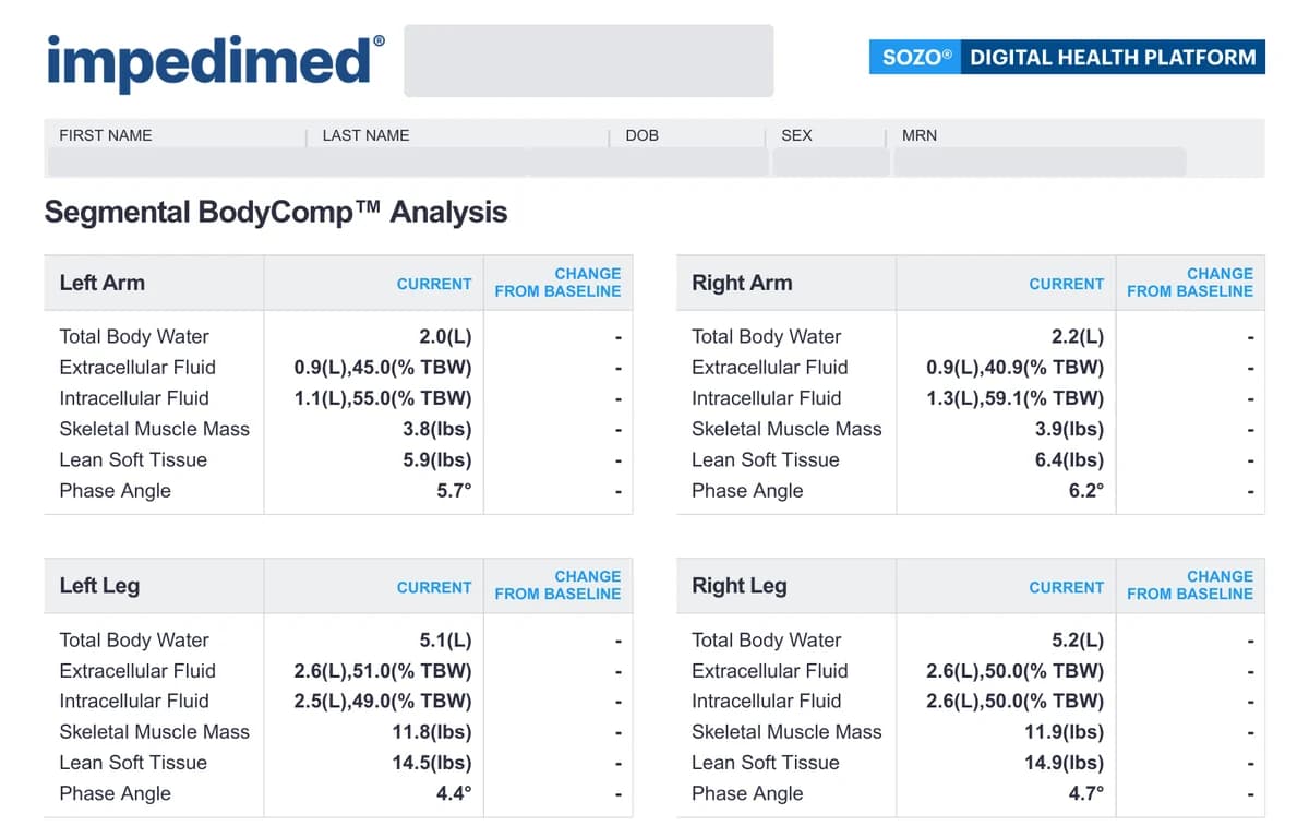 Sample SOZO Segmental BodyComp Analysis: fluid, muscle and phase angle for each arm and leg, with identifying details removed